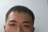 用手机后置拍照脸歪嘴歪怎么办？如何改善手机拍照时的脸部扭曲？