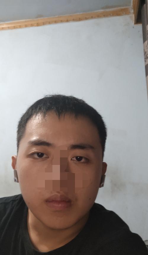 用手机后置拍照脸歪嘴歪怎么办？如何改善手机拍照时的脸部扭曲？  第1张